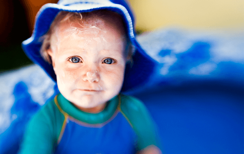 What is baby heat rash and how do you treat it?