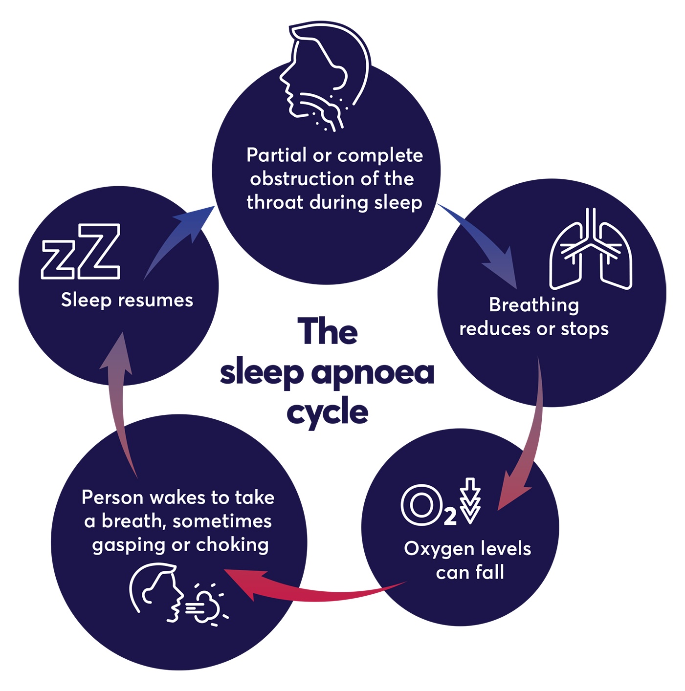 The social stigma of snoring among women: causes and risks - Sleep Cycle