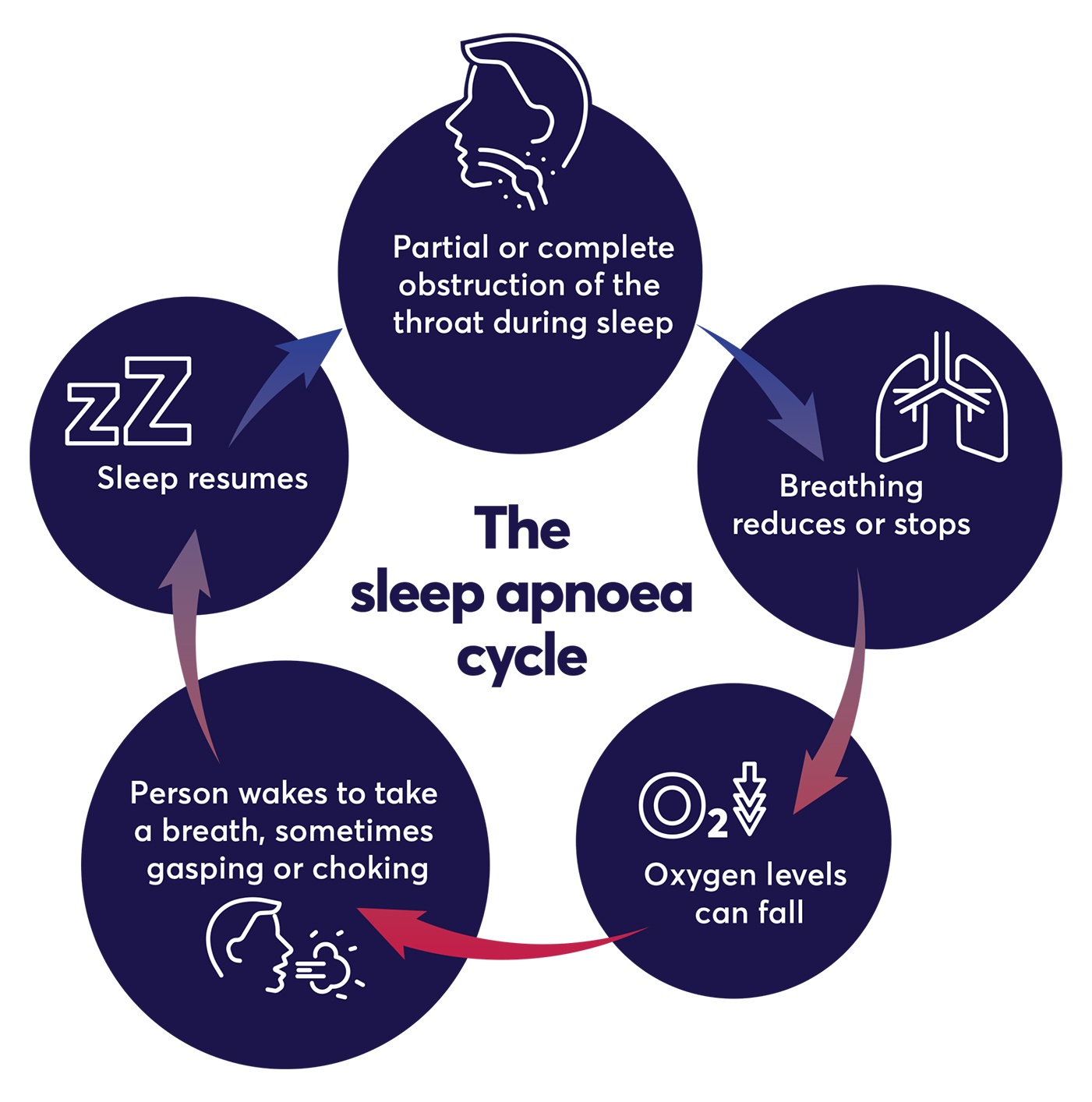 Sleep apnoea, sleep paralysis and other causes of sleep deprivation